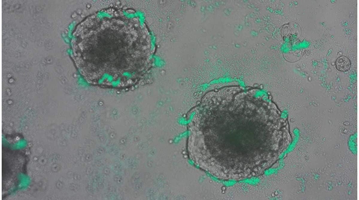 Scientists engineer bacteria to detect cancer DNA